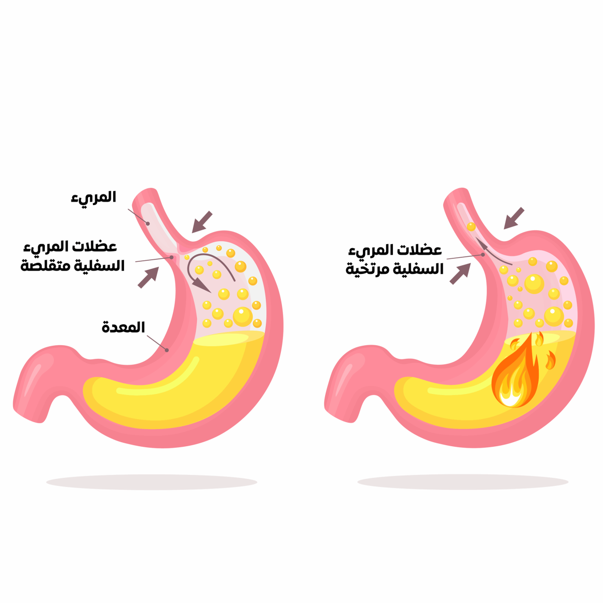 23الارتجاع-المعدي-المريئي-1200x1200.png