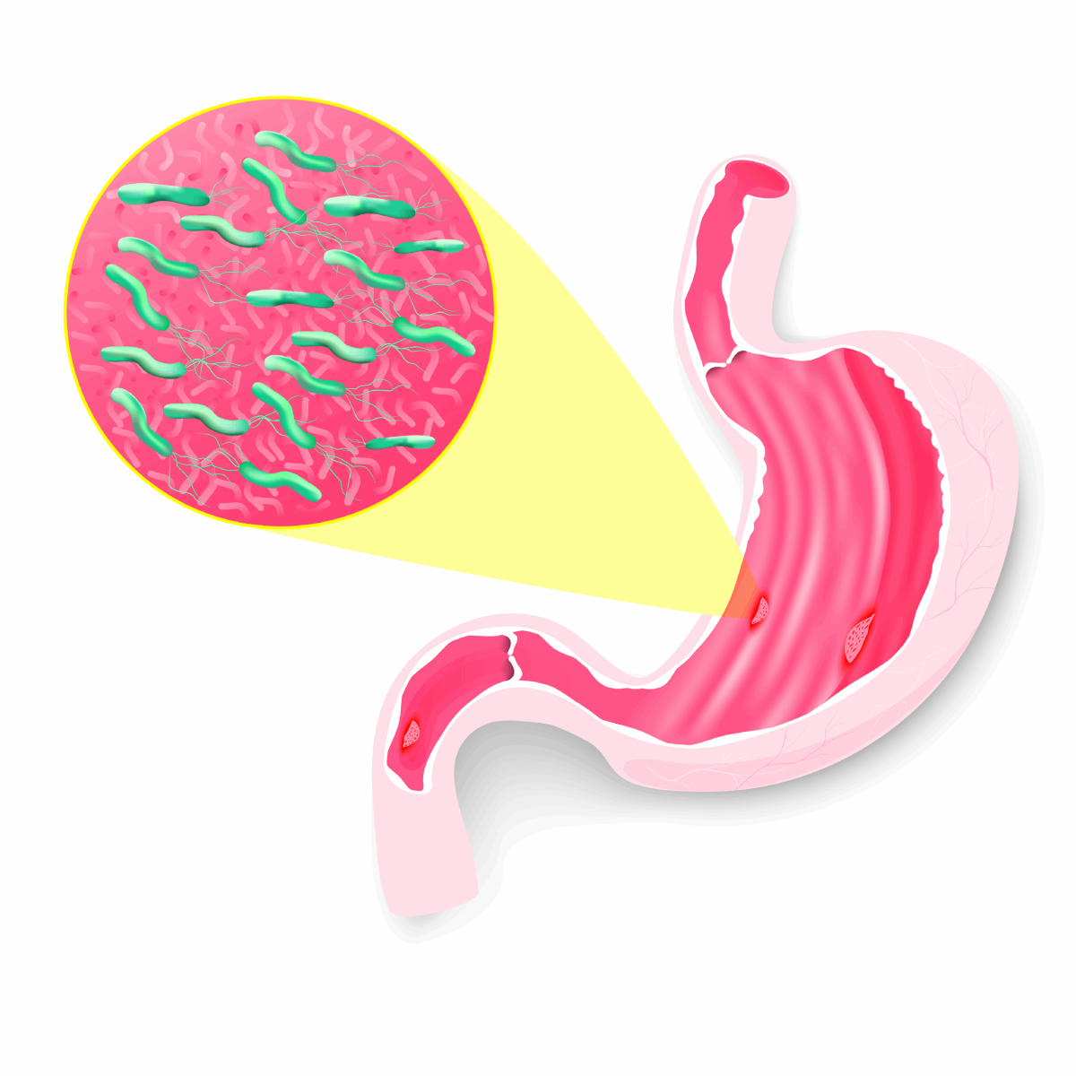 36-what-are-helical-bacteria-1200x1200.png